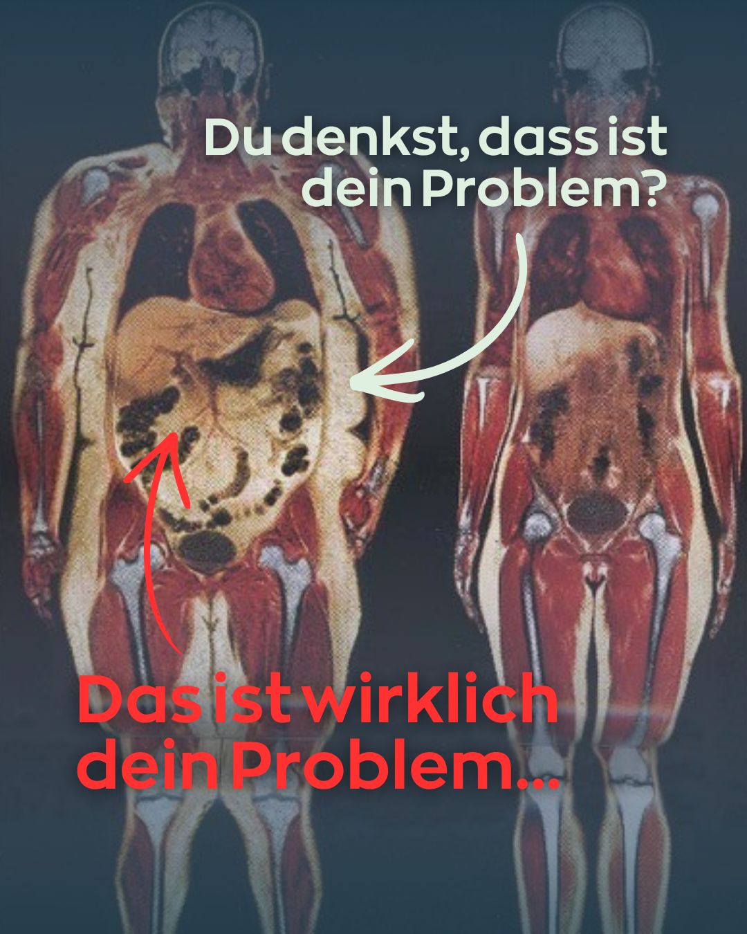 Viszerales Fett: Warum die Waage lügt – und welche Blutwerte wirklich zählen